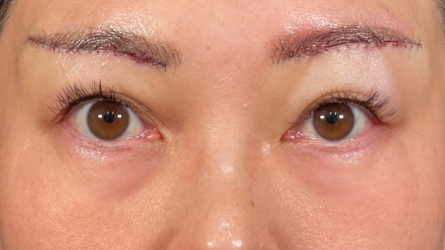 Postoperative Condition Part 1