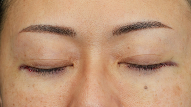 Postoperative Condition Part 1