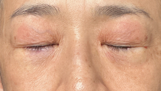 手术前的状态 其一