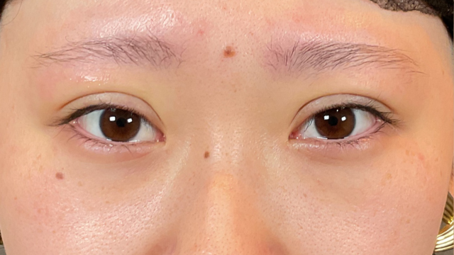 Postoperative Condition Part 1