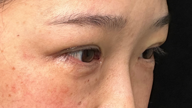 手术前的状态 其一