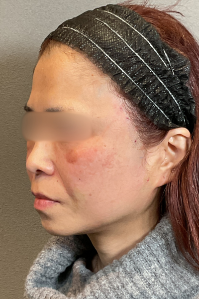 Postoperative Condition Part 1