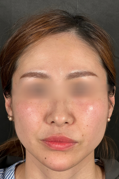 手术前的状态 其一