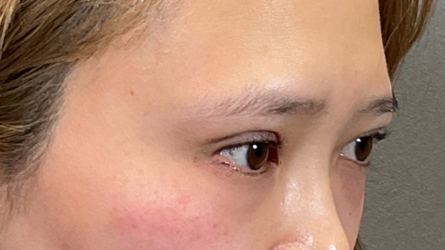 手术前的状态 其一