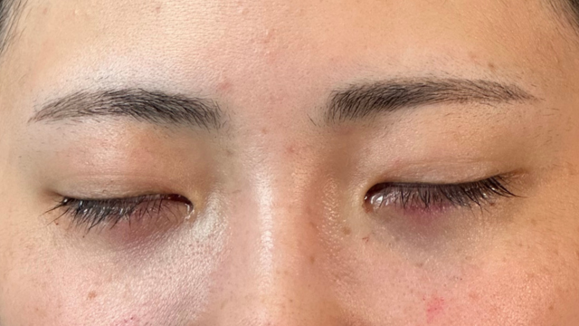 Postoperative Condition Part 1