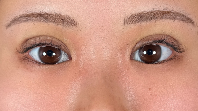 手术前的状态 其一