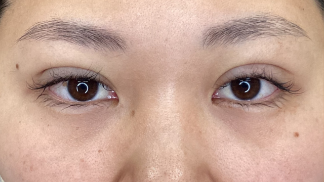 Postoperative Condition Part 1