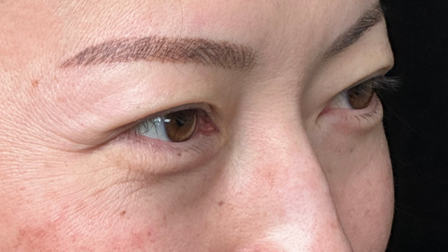 手术前的状态 其一