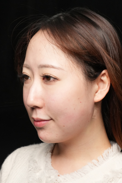 手术前的状态 其一