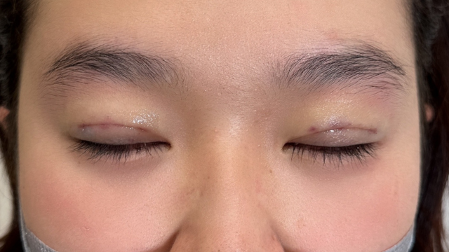 手术前的状态 其一