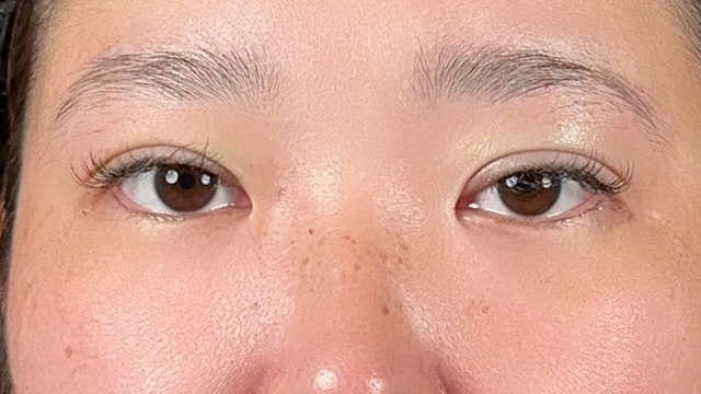 手术前的状态 其一