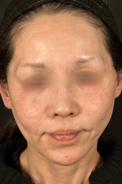 手術前の状態 その1