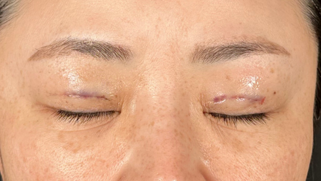 手术前的状态 其一