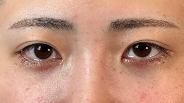 Postoperative Condition Part 1