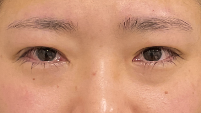 手术前的状态 其一