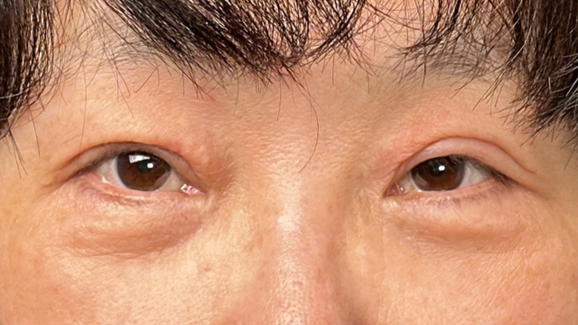 Postoperative Condition Part 1