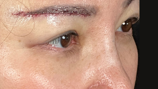 Postoperative Condition Part 1