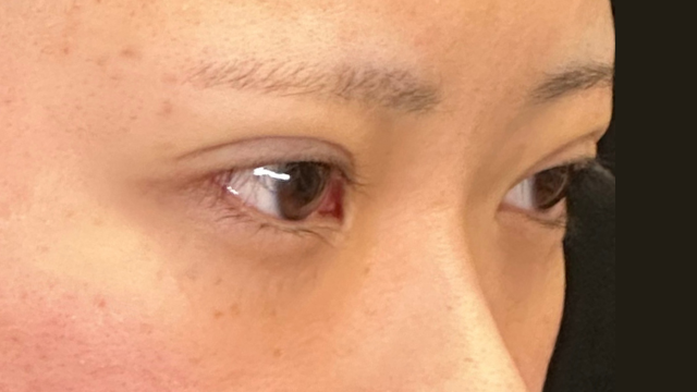 手術前の状態 その1