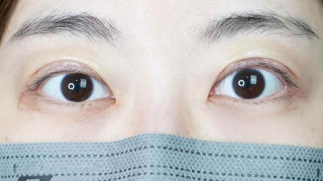 手术前的状态 其一