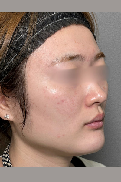 手術前の状態 その1