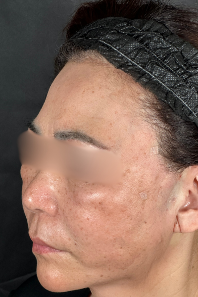 手術前の状態 その1