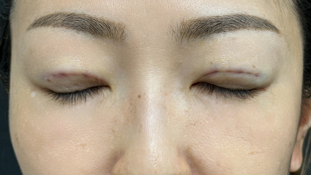 手术前的状态 其一