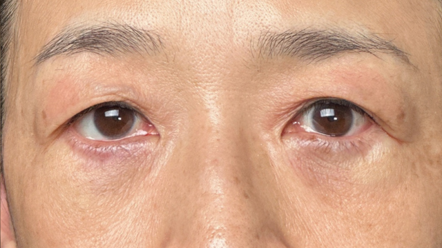 手术前的状态 其一