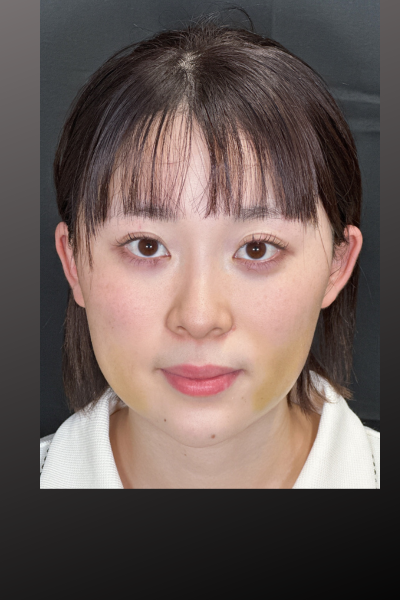 手術前の状態 その1