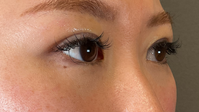 手术前的状态 其一