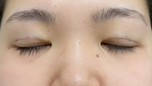 手术前的状态 其一