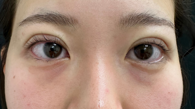 手术前的状态 其一