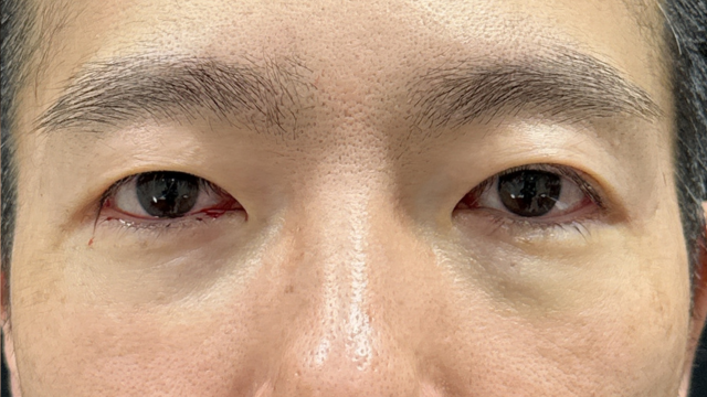 手术前的状态 其一