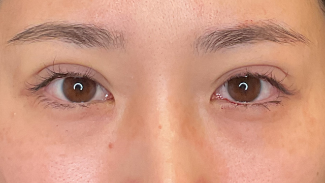 手术前的状态 其一