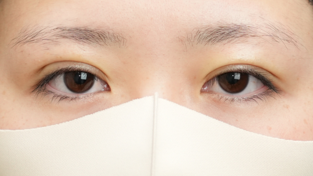 手术前的状态 其一