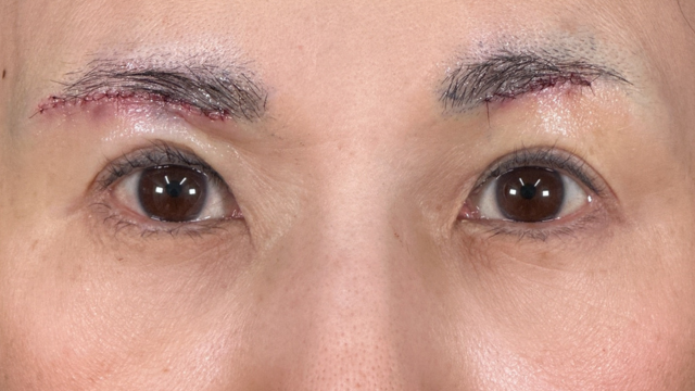 手術前の状態 その1