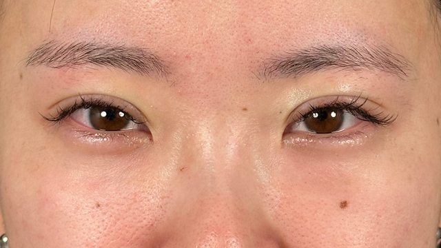 Postoperative Condition Part 1