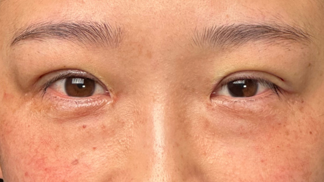 手术前的状态 其一