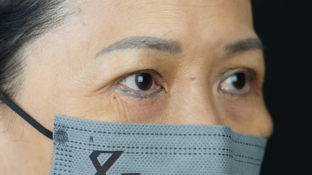 手术前的状态 其一