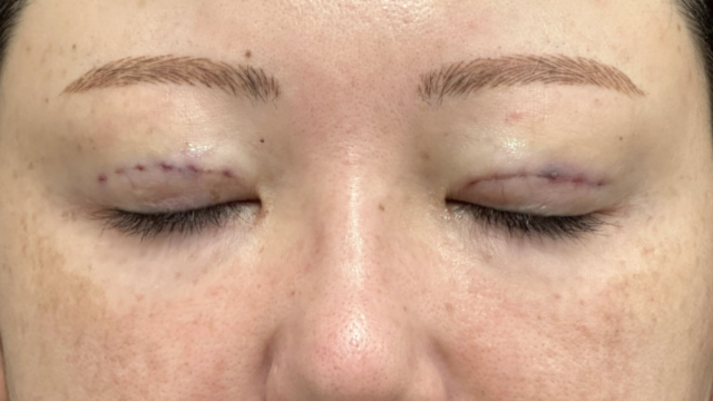 手术前的状态 其一