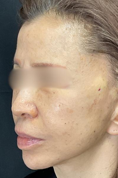 手術前の状態 その1