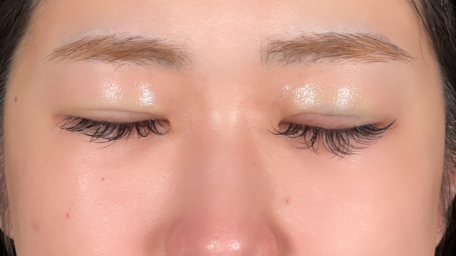 手术前的状态 其一