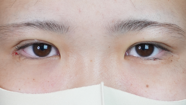 Postoperative Condition Part 1