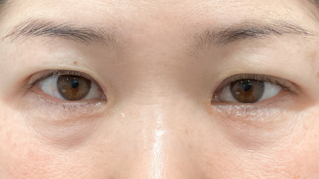 手术前的状态 其一