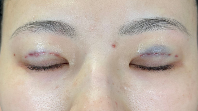 Postoperative Condition Part 1