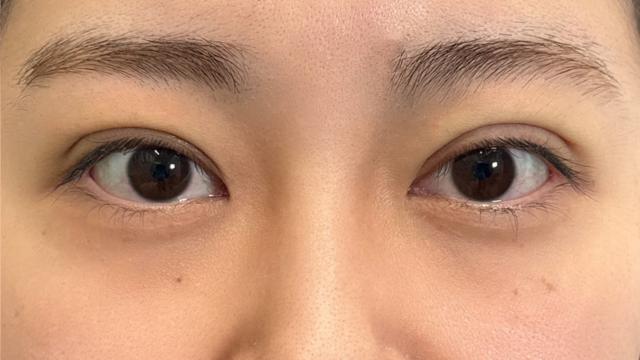 手术前的状态 其一