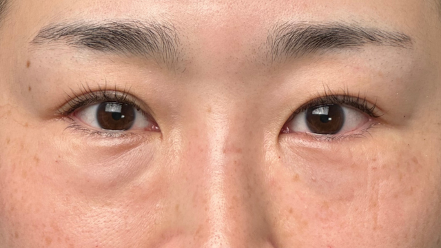 手术前的状态 其一