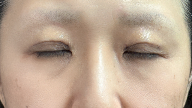 Postoperative Condition Part 1