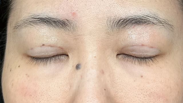 Postoperative Condition Part 1