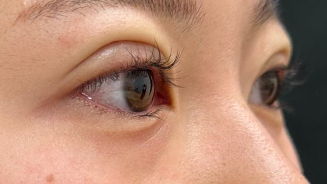 手术前的状态 其一