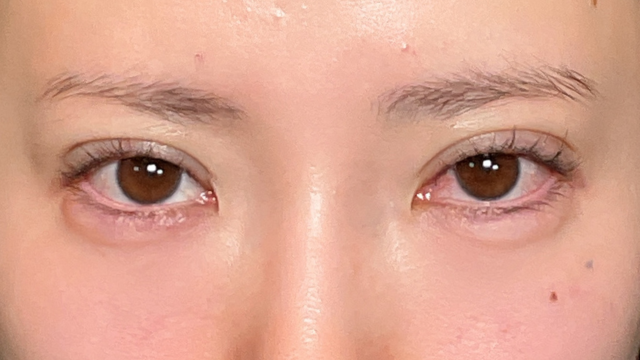 手术前的状态 其一